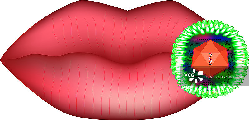 疱疹病毒对唇的解剖结构图片素材