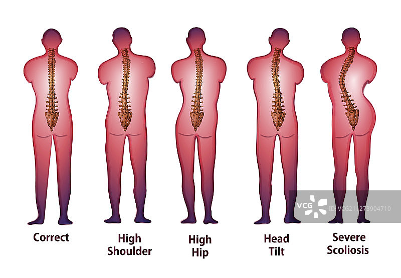 人体脊柱姿势后视图图片素材