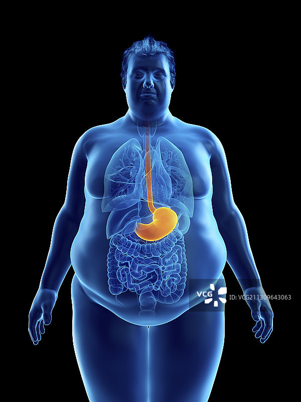 一个肥胖男子的胃的插图图片素材