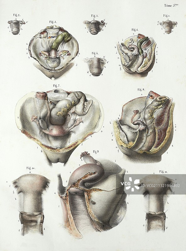 子宫解剖学，1839年艺术品图片素材