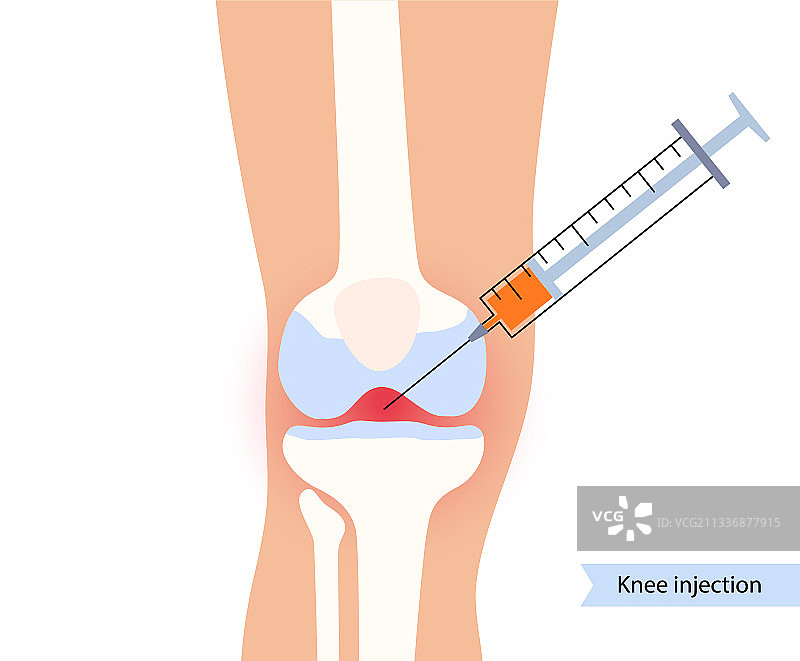 膝盖注射的概念图片素材