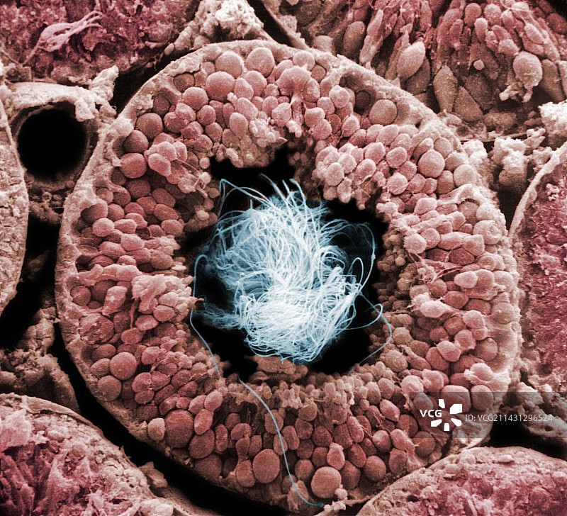 人类睾丸小管内充满精子图片素材