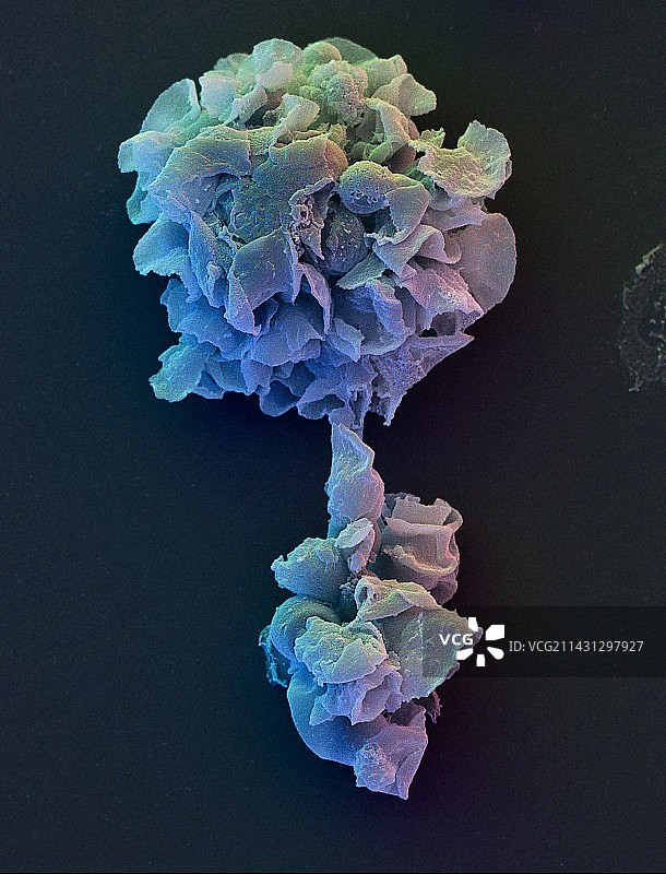 吞噬型巨噬细胞的彩色扫描电镜图片素材
