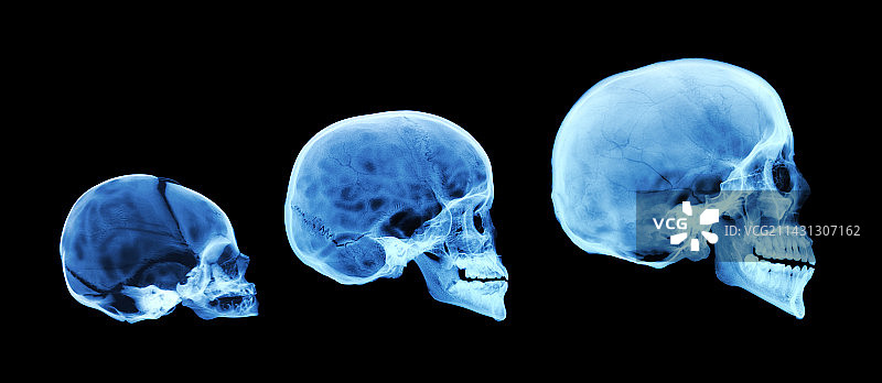 人类头骨发育图片素材