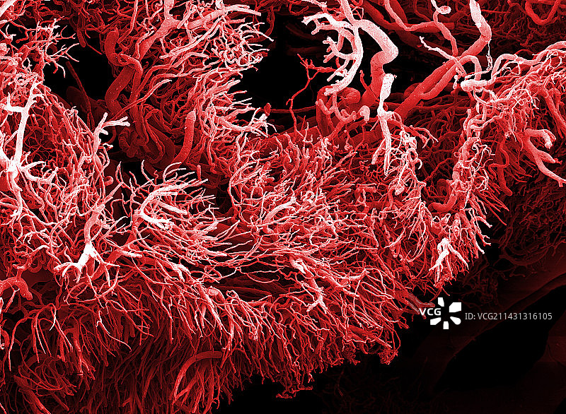 肿瘤血管，扫描电镜图片素材