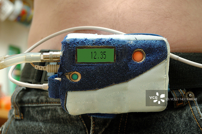 动态血压监测仪图片素材