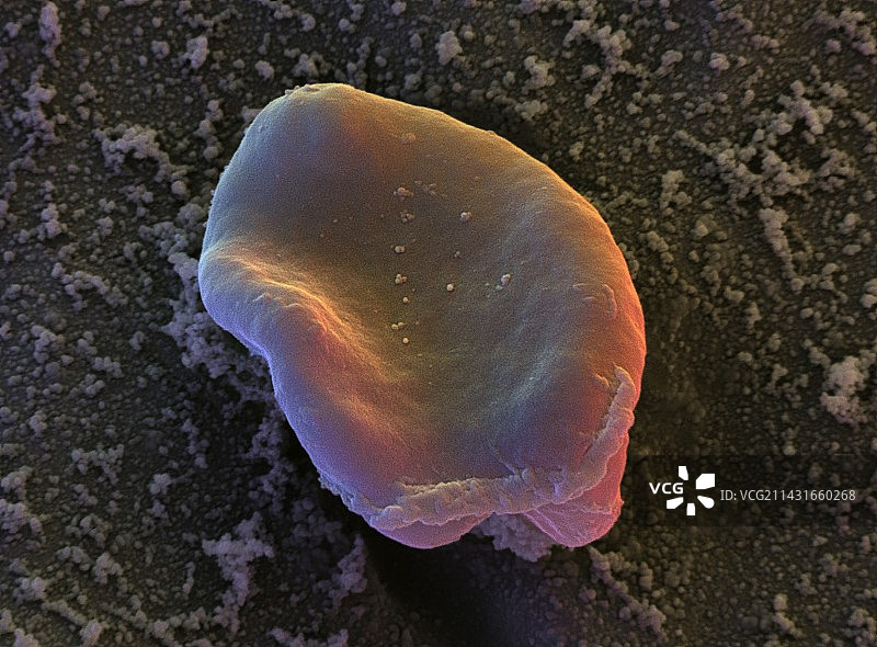 疟疾感染红细胞扫描电镜图片素材