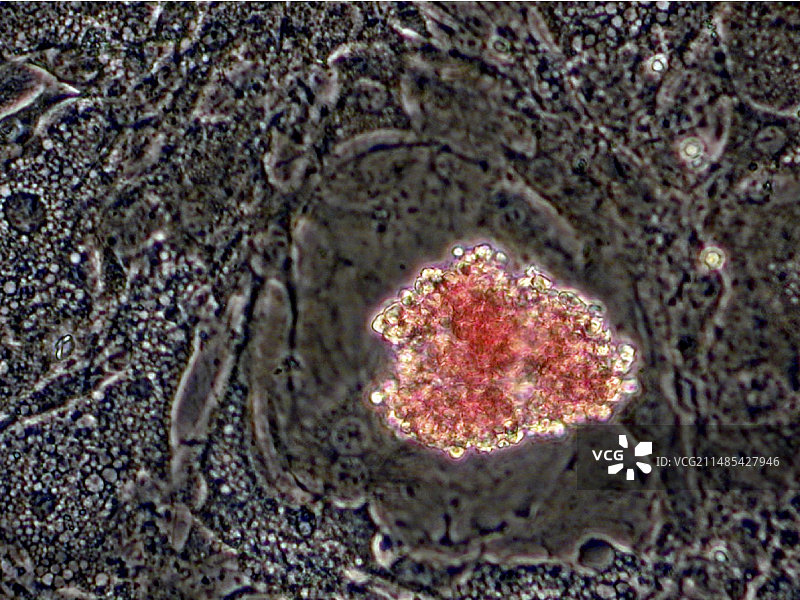 人造红细胞，显微照片图片素材