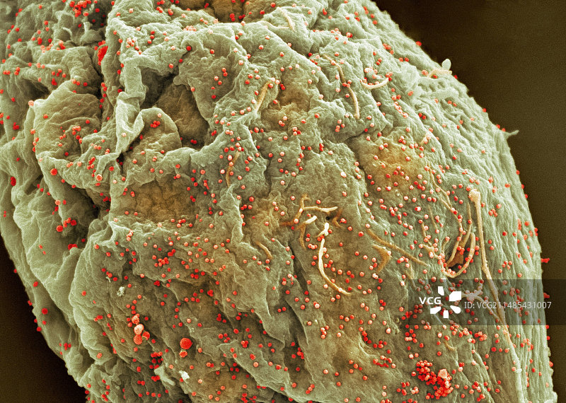 感染HIV的细胞，扫描电镜图片素材