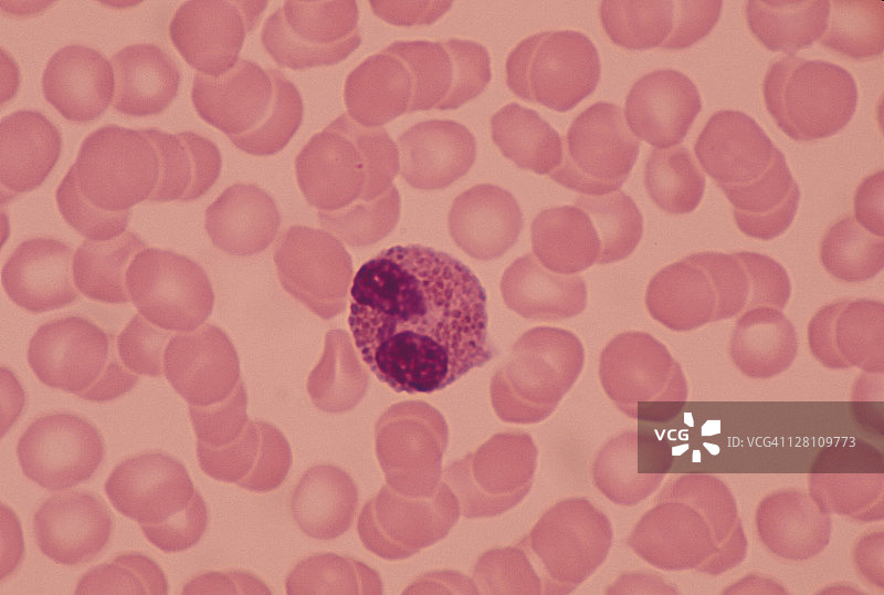 嗜酸性粒细胞(wbc)双叶核和红色的胞浆颗粒。400 x图片素材