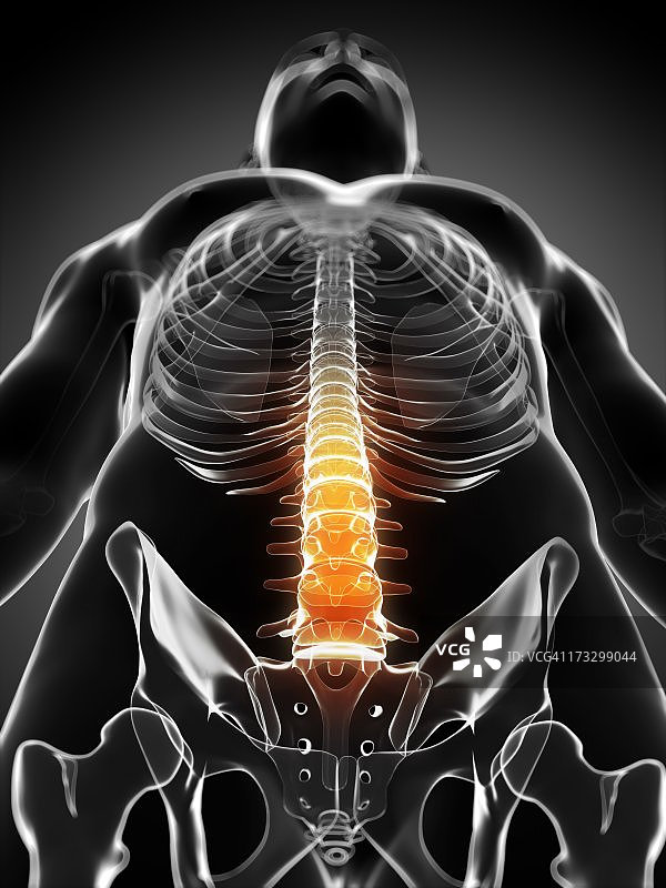 背部疼痛，概念艺术品图片素材