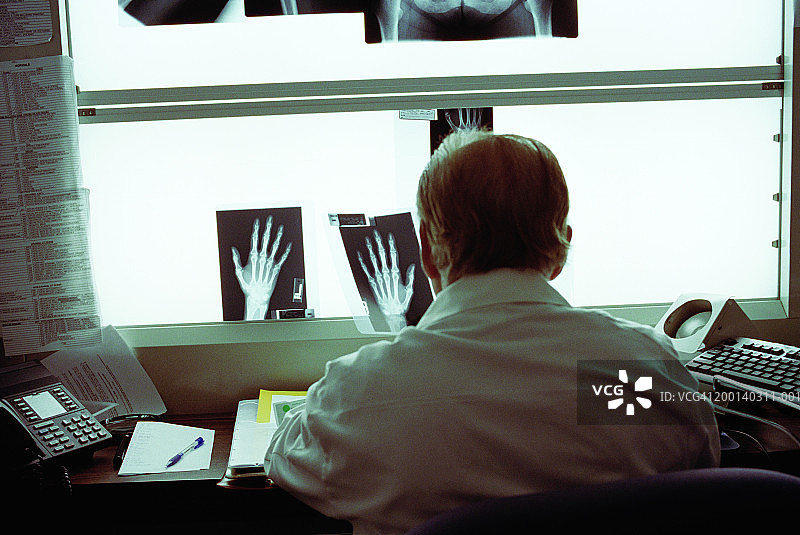放射科医生看了手的x光片，后视图图片素材
