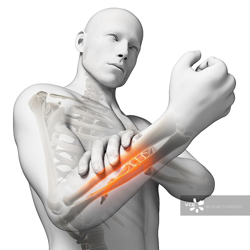 人类手臂疼痛，艺术品图片素材