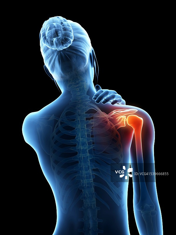 人类肩膀疼痛，说明图片素材
