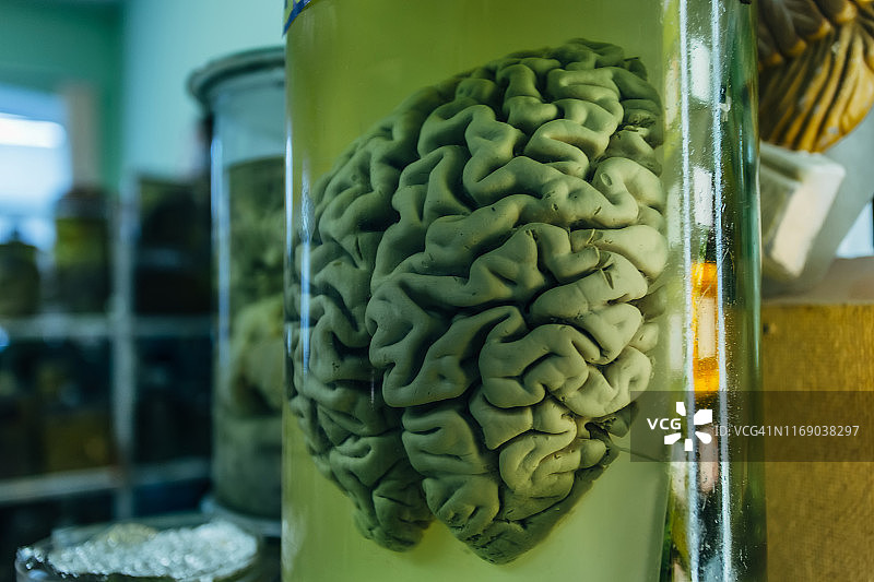 人体大脑装在装有甲醛的玻璃罐中用于医学研究图片素材