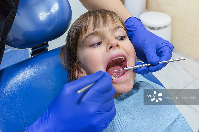 一个小女孩在牙科检查期间张开她的嘴的特写图片素材