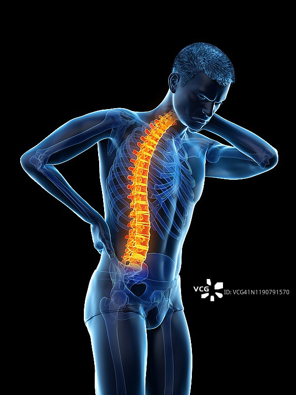 背部疼痛，概念说明图片素材