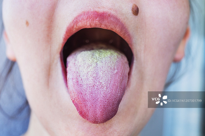 女人舌头上有绿色残留物的特写图片素材