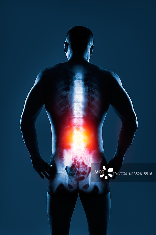 蓝色背景x射线下的人体脊柱。腰椎骨用黄红色标出。图片素材