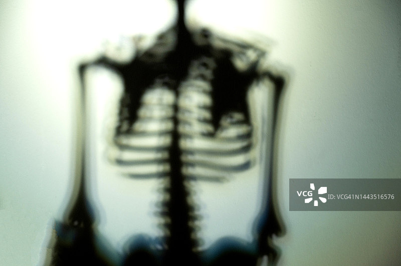 人类的骨骼。一个人的x光片。《另类》采用了人体解剖学。图片素材