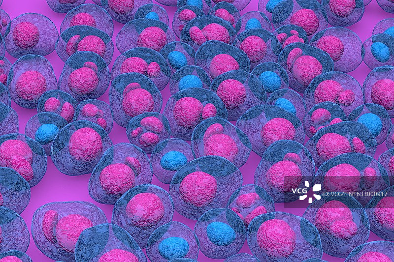 多发性骨髓瘤白血病-三维彩色渲染插图等距视图图片素材
