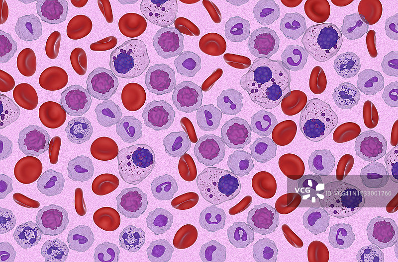 血流中的多发性骨髓瘤(MM)细胞-显微镜视图3d插图图片素材