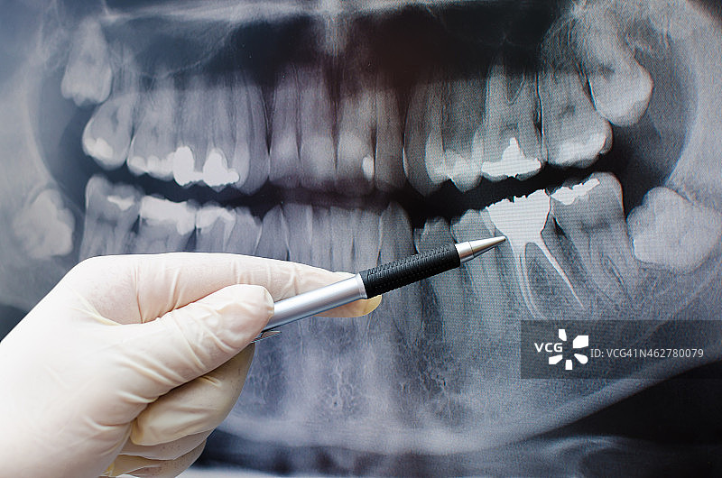 牙科医生在牙科x光图像上显示了一些东西图片素材