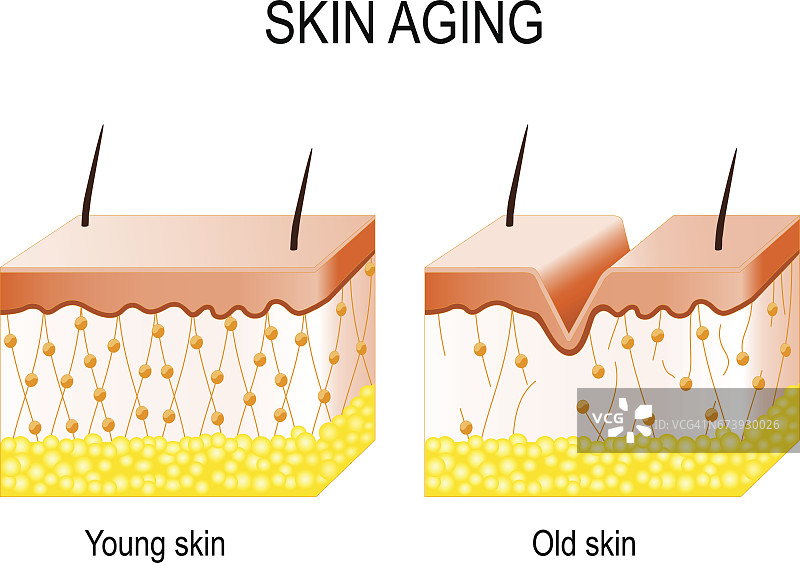 年轻和年老皮肤中的胶原蛋白。年轻和年老皮肤中的胶原蛋白。图片素材