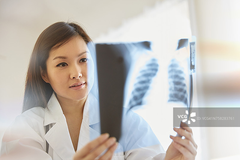 中国医生正在检查胸部x光片图片素材