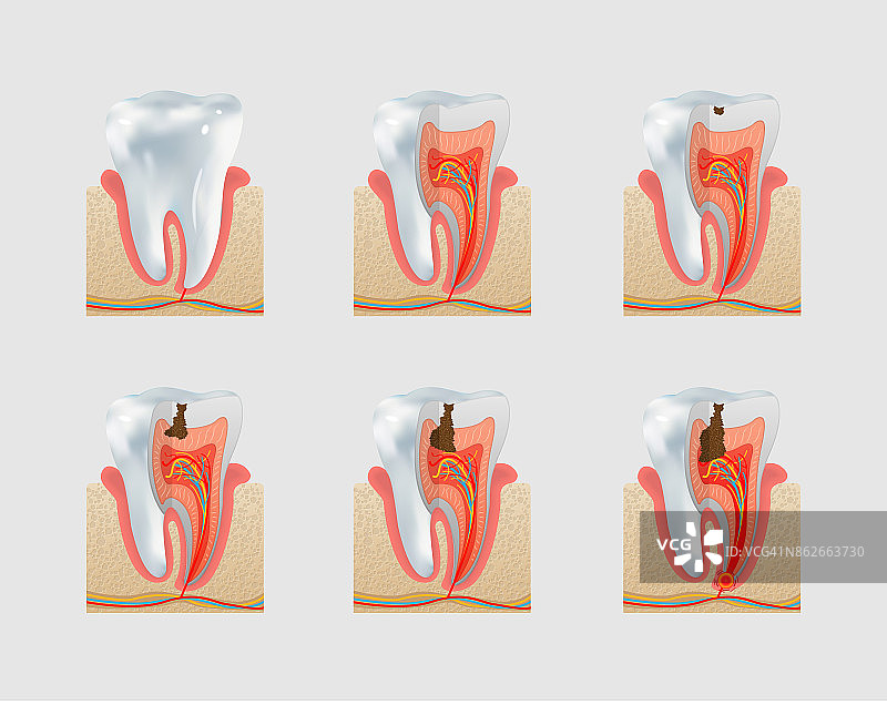 矢量健康牙齿和龋齿图标设置图片素材