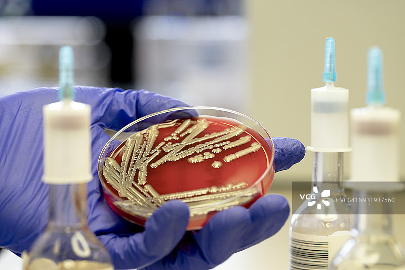 大肠杆菌(E. coli)菌落图片素材