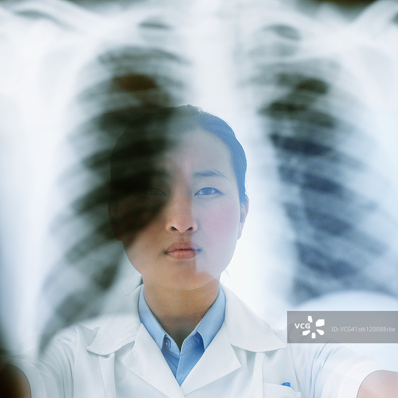 一个女性医疗专业人员举着x光片的特写图片素材
