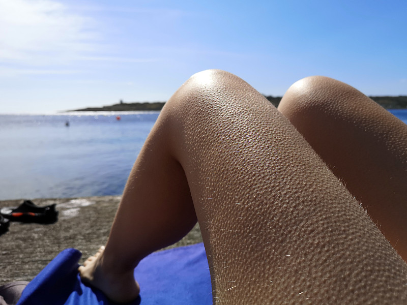 一个女人腿上起鸡皮疙瘩的特写，布吉巴，马耳他图片下载