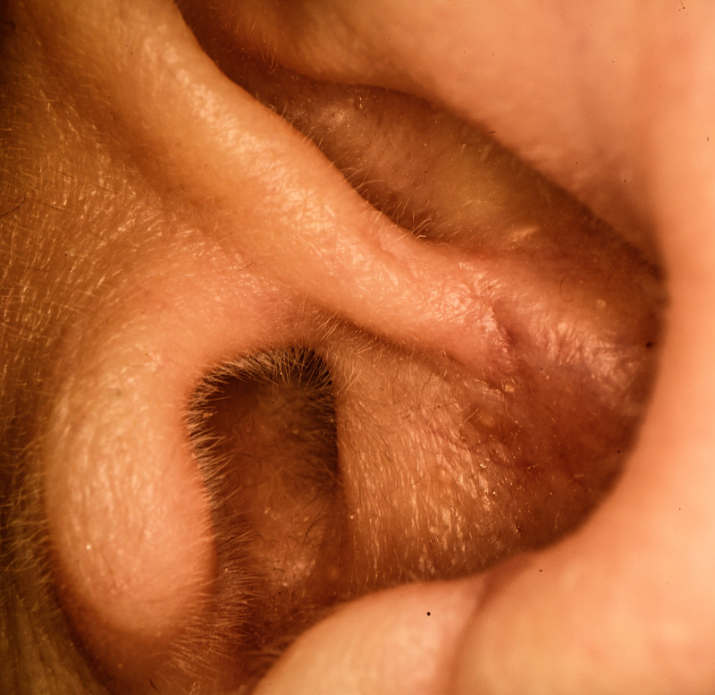 人的耳朵。图片下载