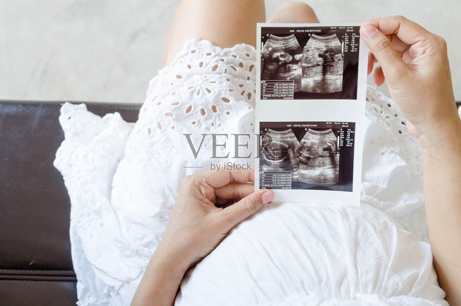孕妇抱着超声波扫描的特写照片摄影图片
