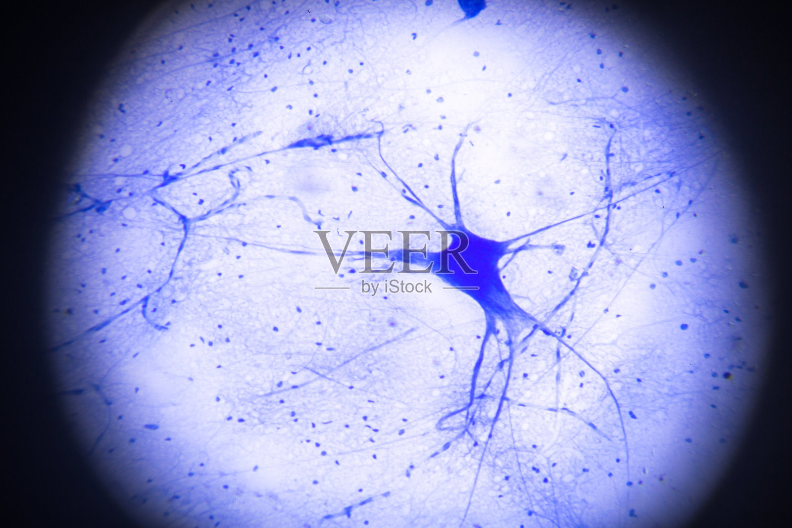 显微镜下的运动神经细胞照片摄影图片