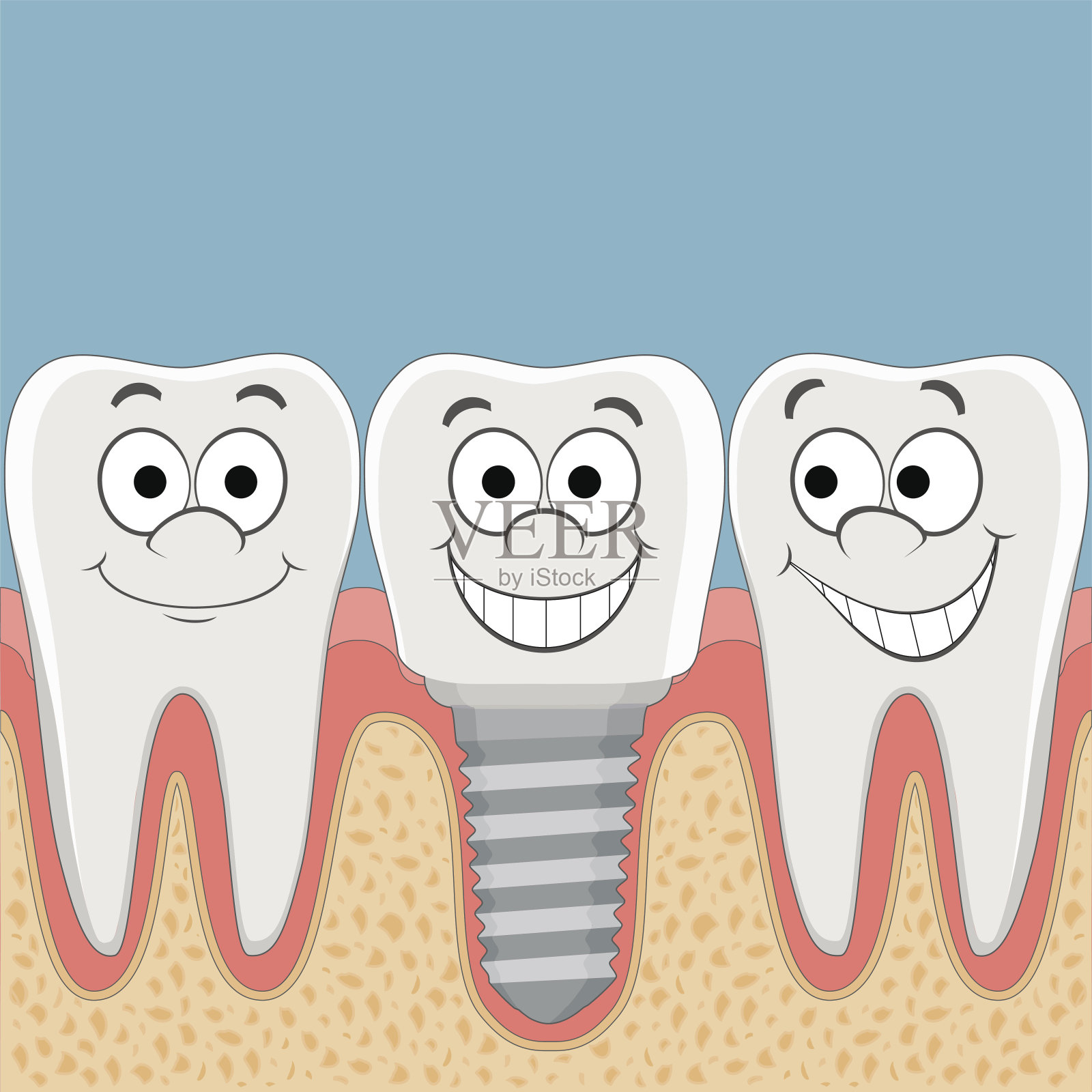 人类牙齿和植牙。插画图片素材