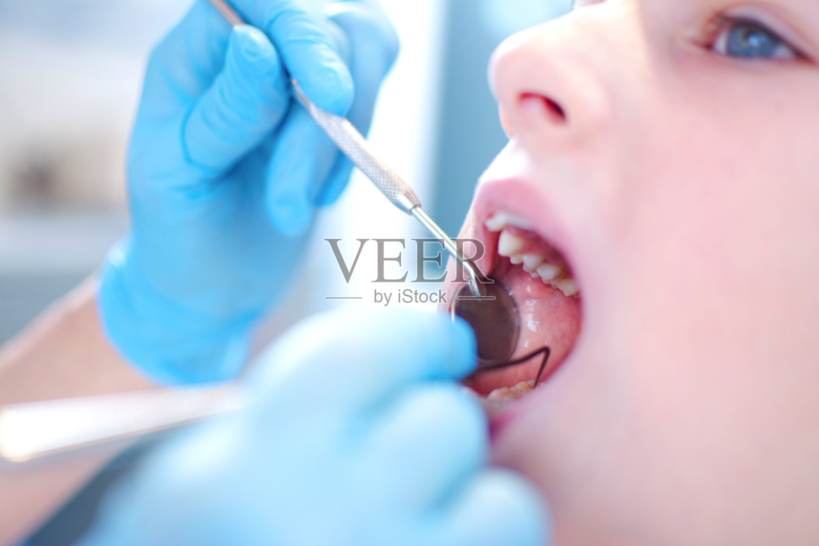年轻女孩的近距离与张开的嘴有她的牙齿检查的牙医。照片摄影图片