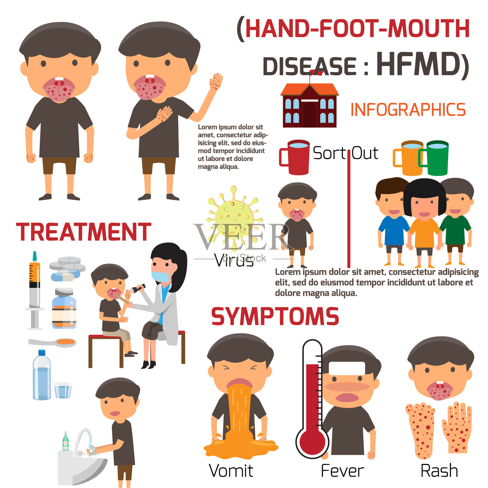 手足口病儿童感染。海报详细的手足口病信息图与症状预防和治疗。卡通健康概念矢量插图。插画图片素材