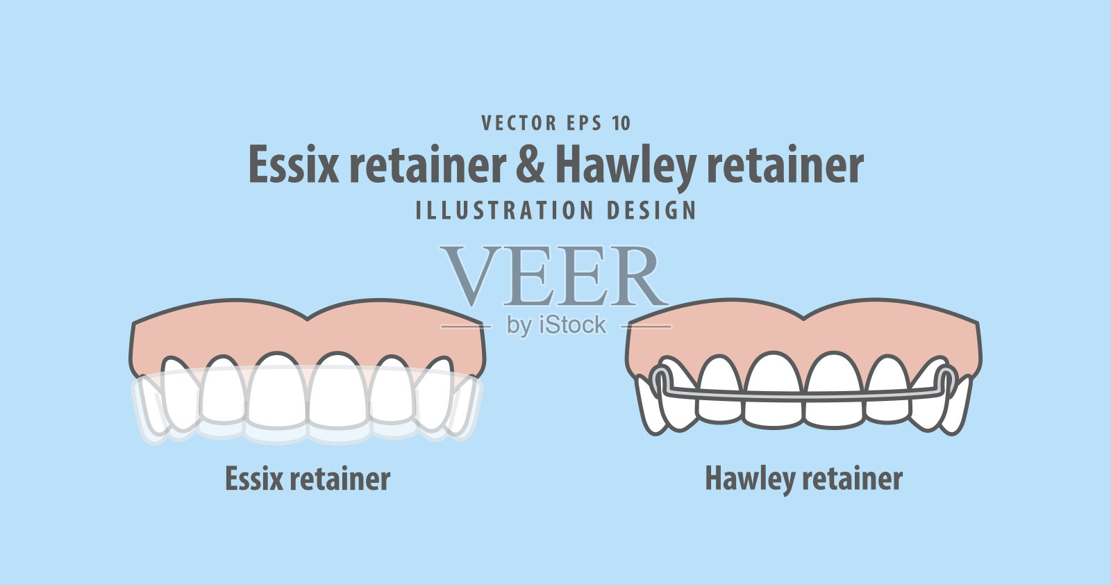 Essix挡圈& Hawley挡圈插图矢量在蓝色背景。牙科的概念。插画图片素材