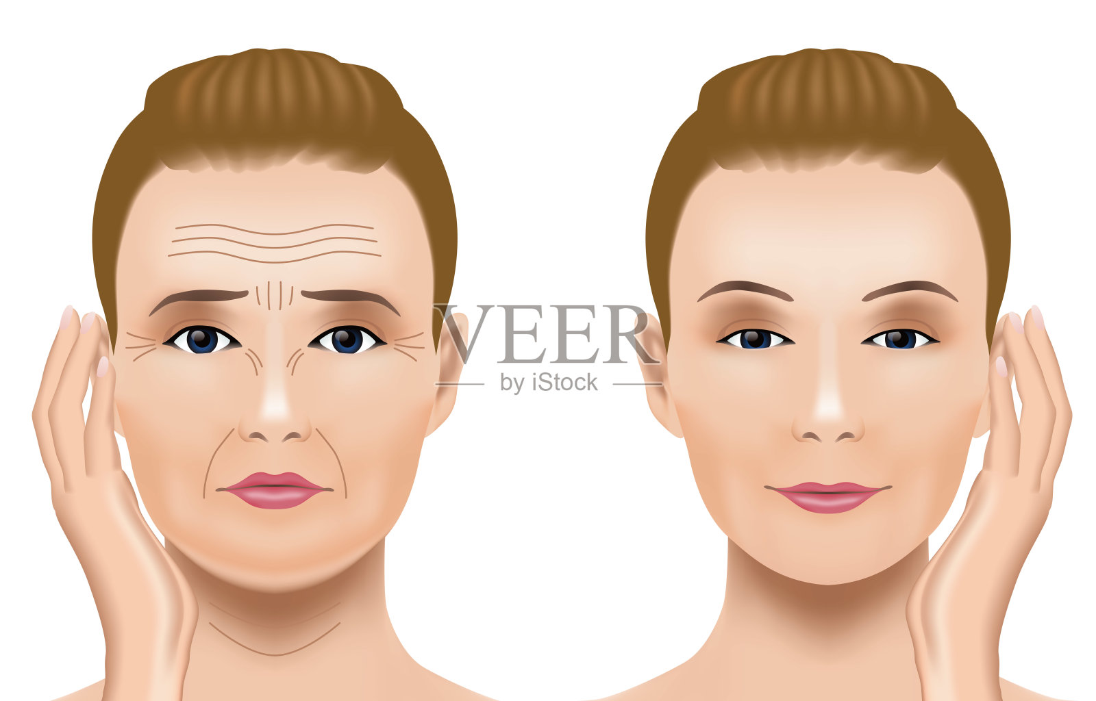 面部皱纹治疗前后。整容手术。女性面部护理理念。插画图片素材