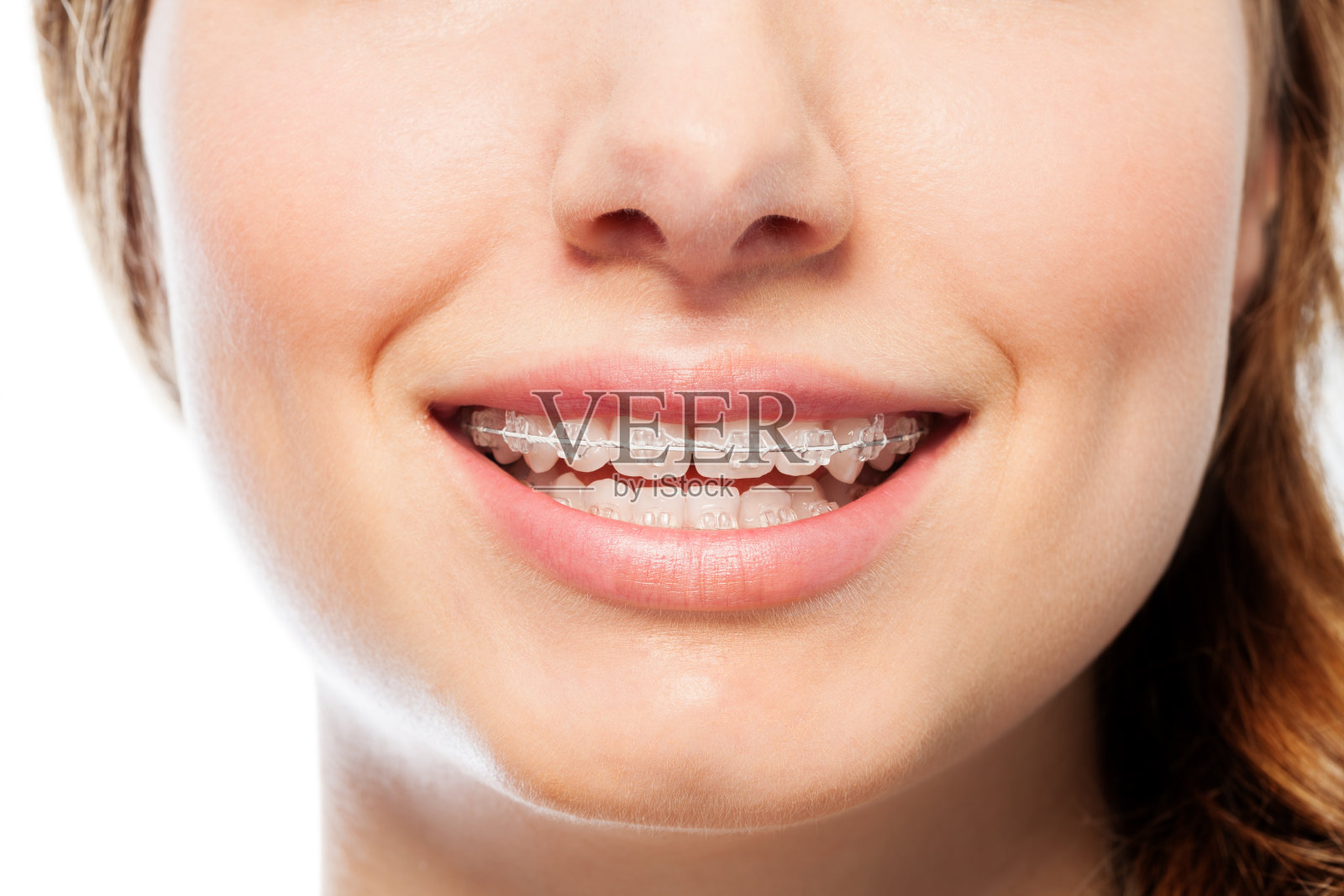 快乐女人的微笑带着牙齿矫正干净的牙套照片摄影图片