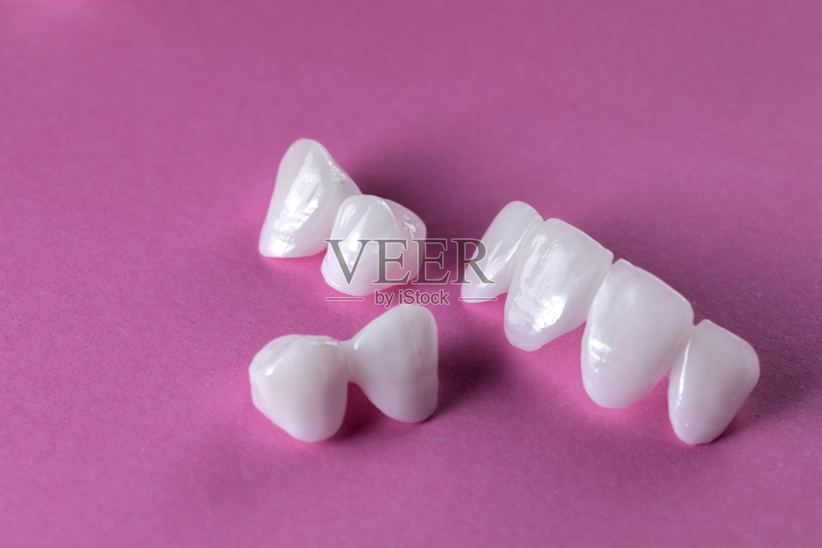 粉色背景上的锆石假牙-陶瓷贴面-发光器照片摄影图片