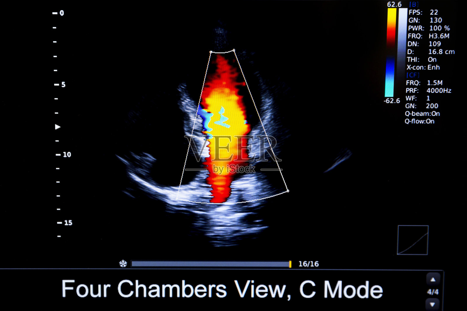 彩色人体心脏超声监测仪图像照片摄影图片
