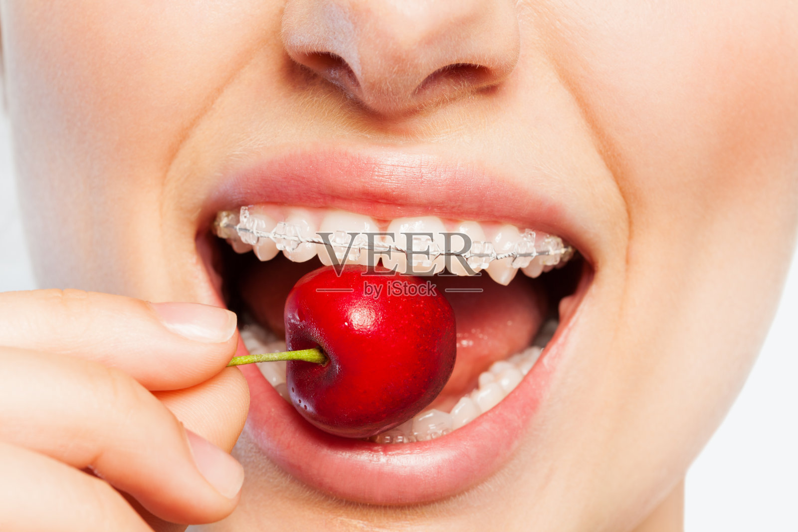 戴着牙套的女人正在咬熟樱桃照片摄影图片