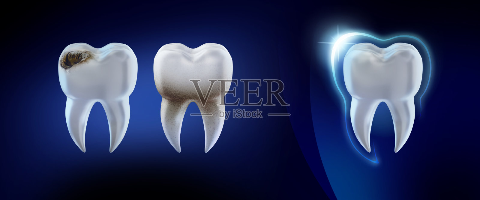 牙科的概念。3d渲染图清洁和肮脏的牙齿隔离在蓝色，清除牙齿的过程。牙齿美白。口腔护理，牙齿修复。照片摄影图片