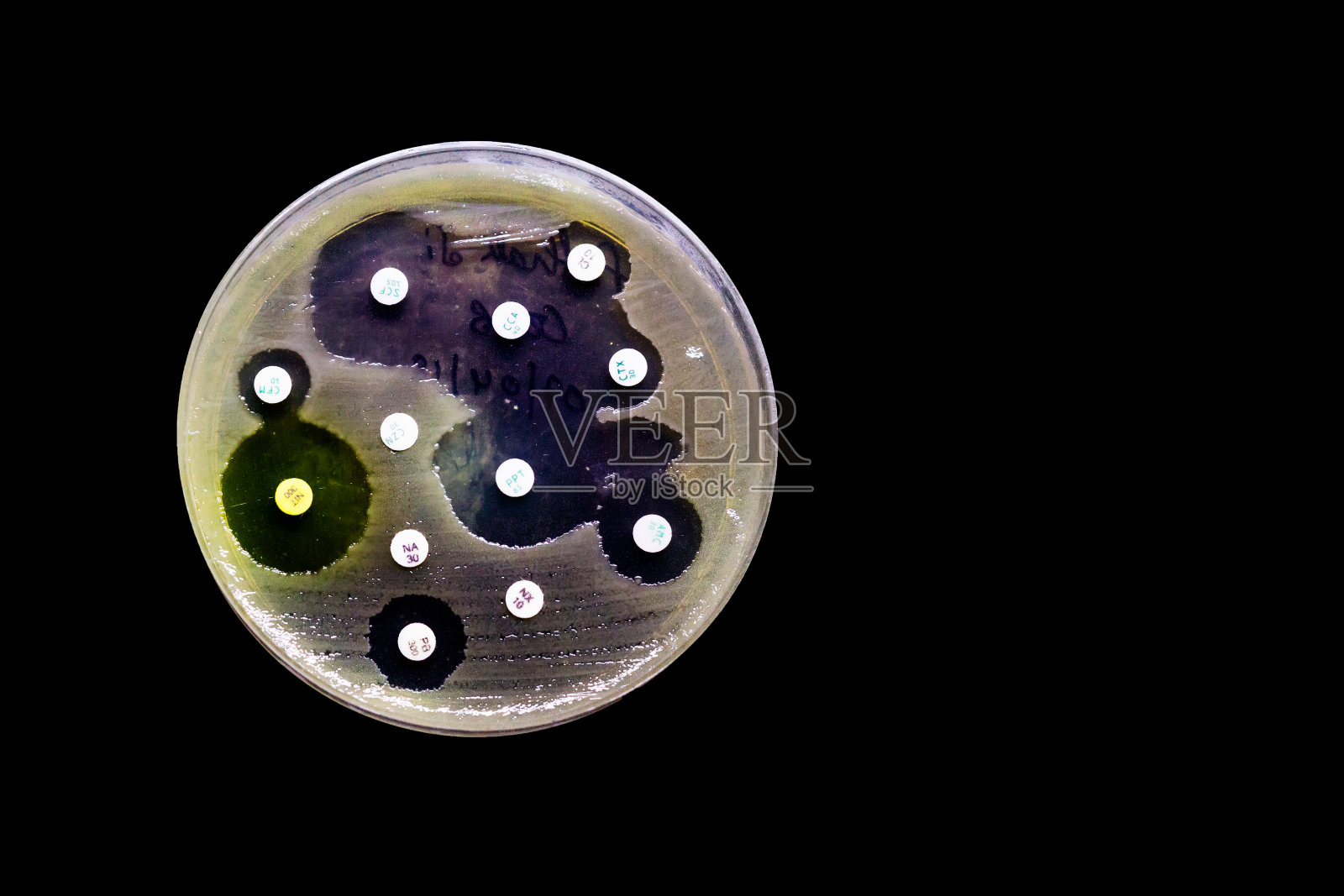 细菌生长培养板显示其菌落模式孤立在黑色背景抗生素敏感性照片摄影图片