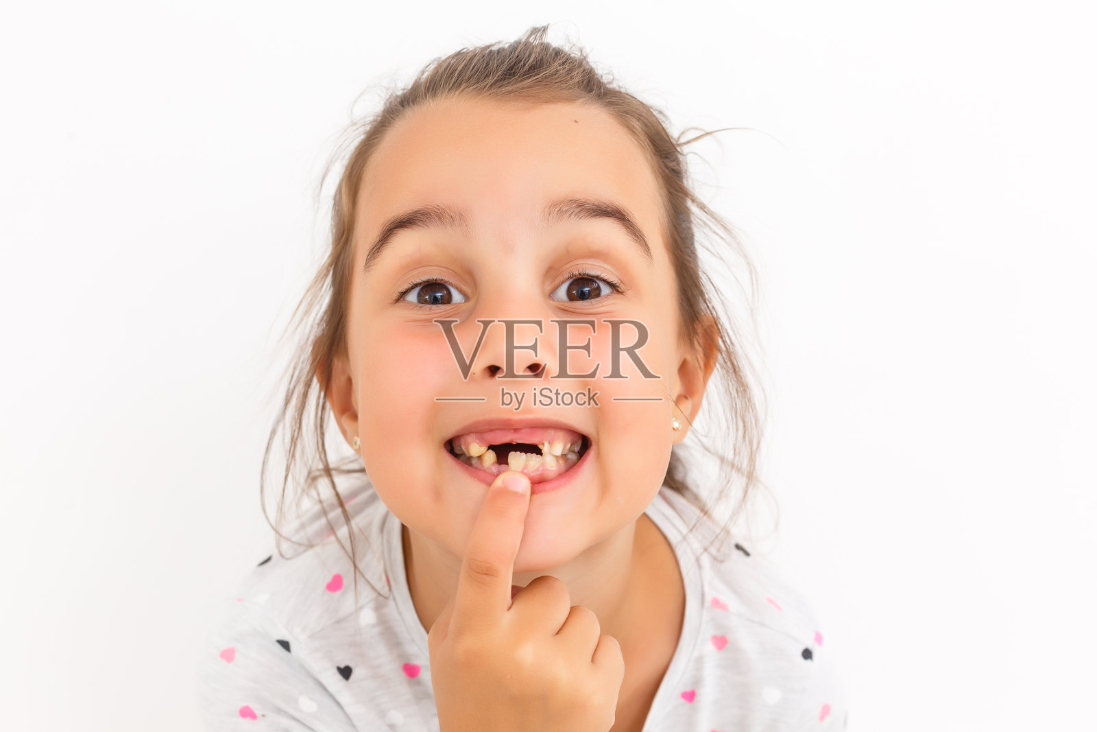 小女孩的第一颗牙齿在白色的背景上脱落照片摄影图片