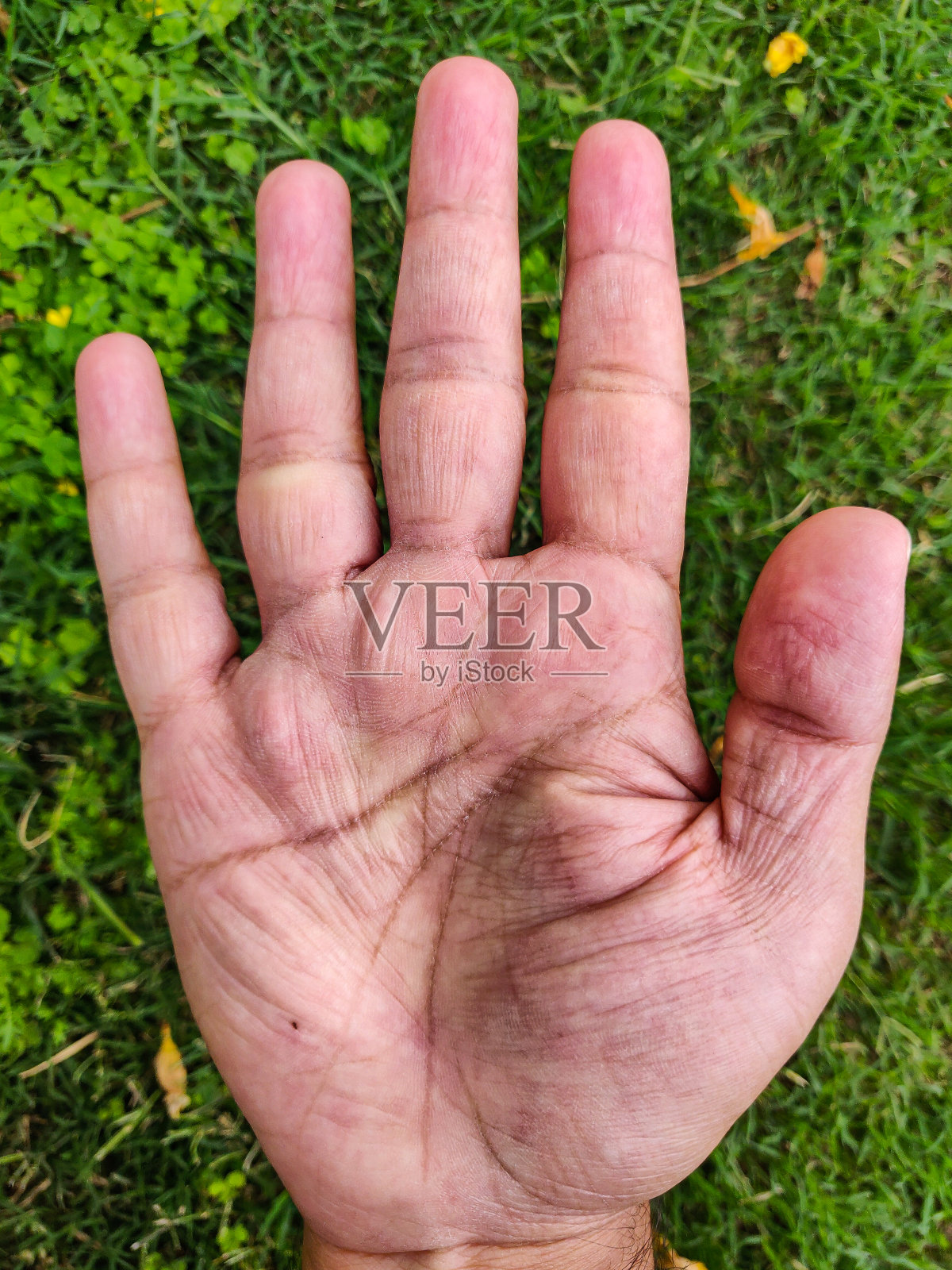 一只男性的手掌孤立在绿草的背景下。关闭干燥的皮肤和皱纹的人完全摊开手掌由于化学消毒剂和手洗使用。照片摄影图片